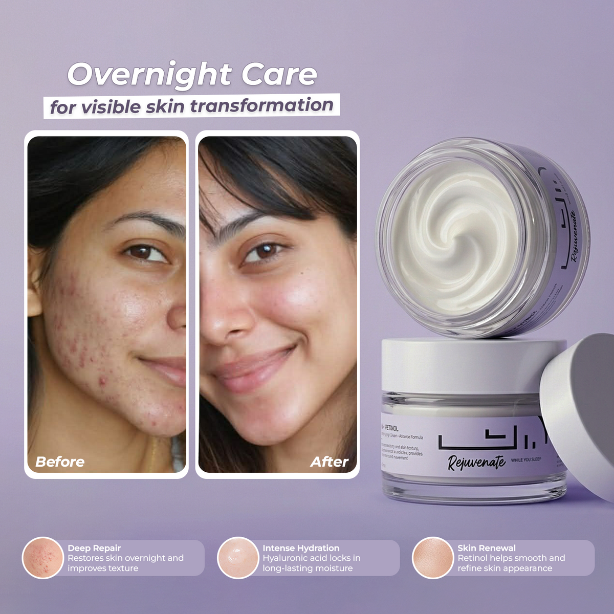 HA+Retinol Advanced Night Cream with Squalane & Vitamin E| 50.0 gm