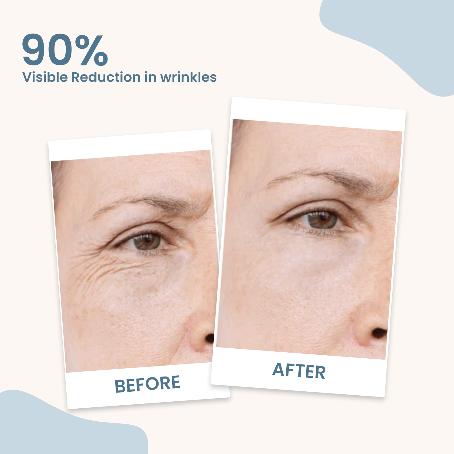 retinol before and after