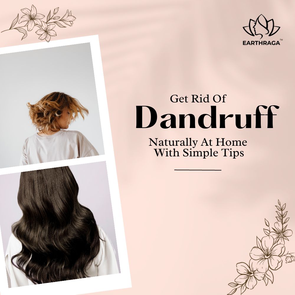 Get Rid Of Dandruff Naturally At Home With These Simple Tips