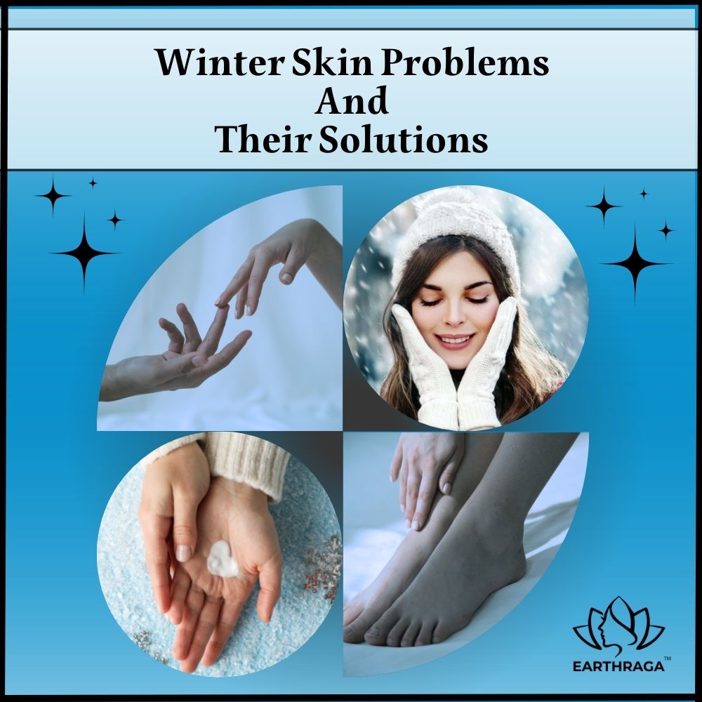 winter skin problems