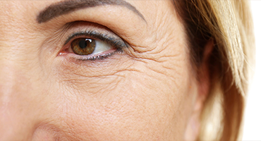 FINE LINES & WRINKLES